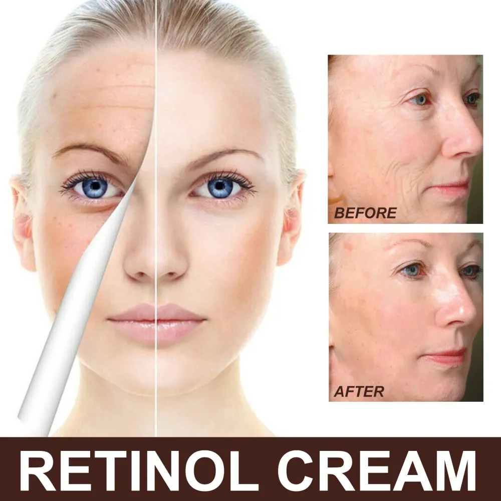 EELHOE Retinol Cream - Anti-aging, Firming, Brightening, Moisturizing Facial Skincare Cream-WH