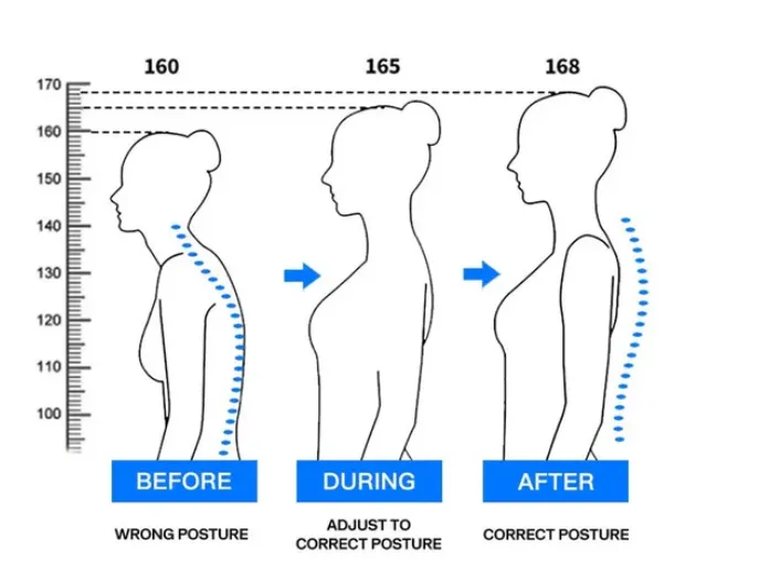 Posture Corrector