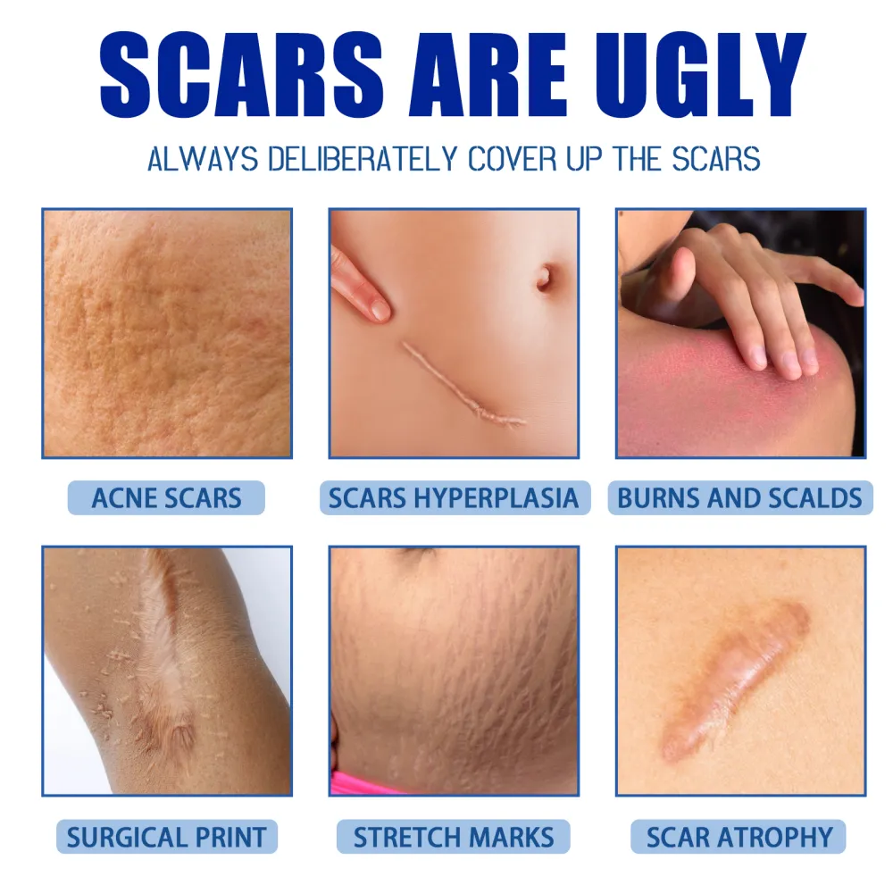 Scar Cream - Softens and smoothens scars, tightens and firms the skin, and provides skin repair.