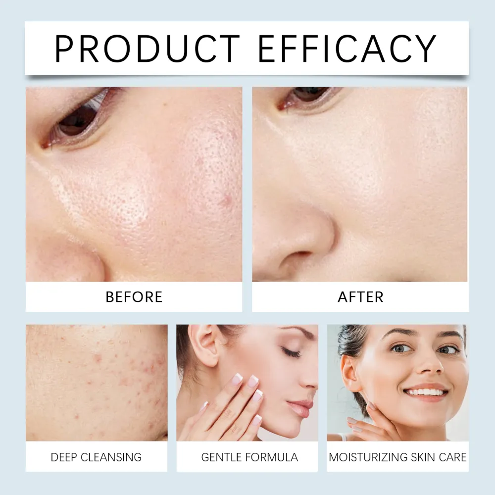 Facial Cleansing Oil: Deeply and gently removes makeup and soothes the face and lips. Use this light and non-tightening cleansing oil.