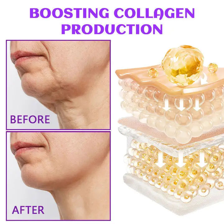 ✨Last Day Discount: 70% OFF🌸Neck Cream