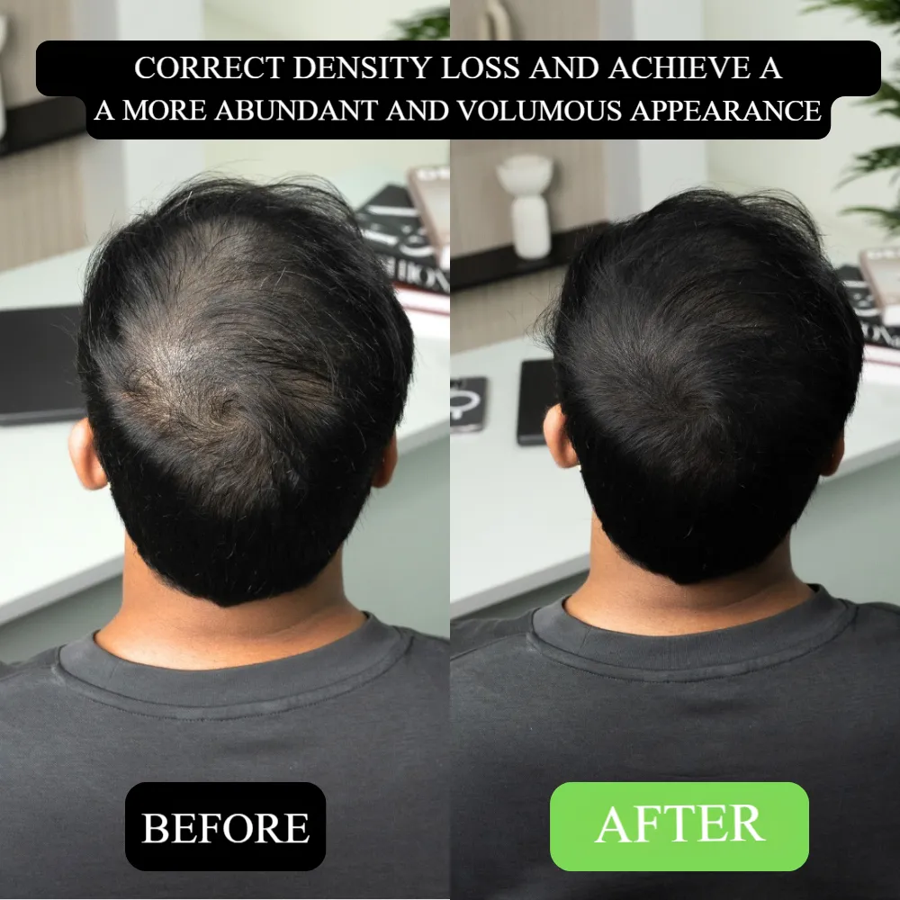 Say Goodbye to Receding Hairlines! Hairline Shadow Powder, Redefine Your Perfect Hairline