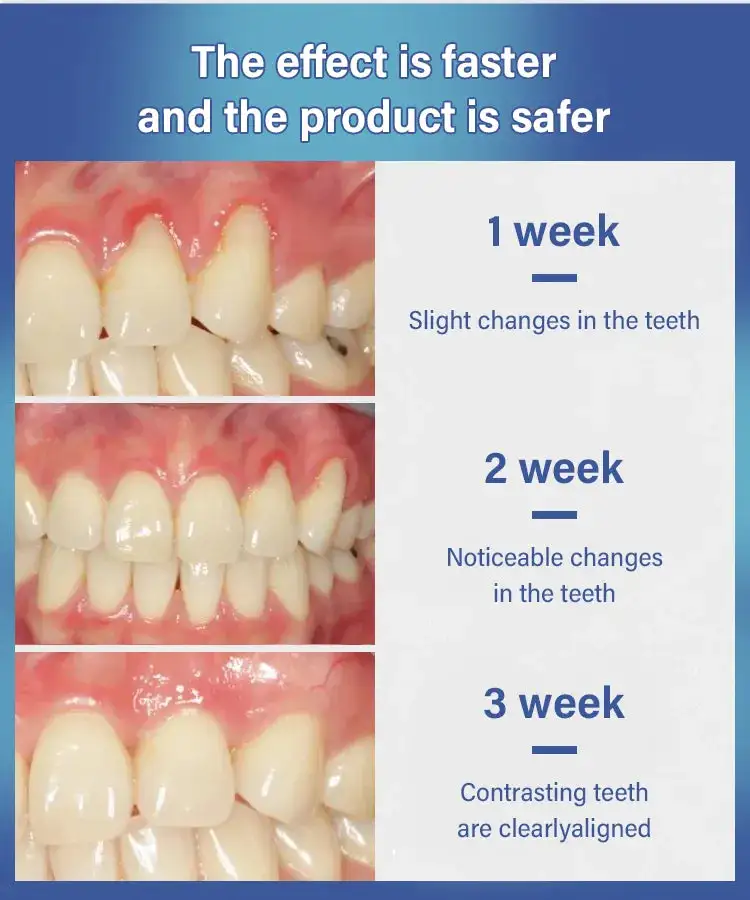 Tooth Repair Gel, Max 80% Off - Clean Deep, Firm Tartar, Soothe Gums!