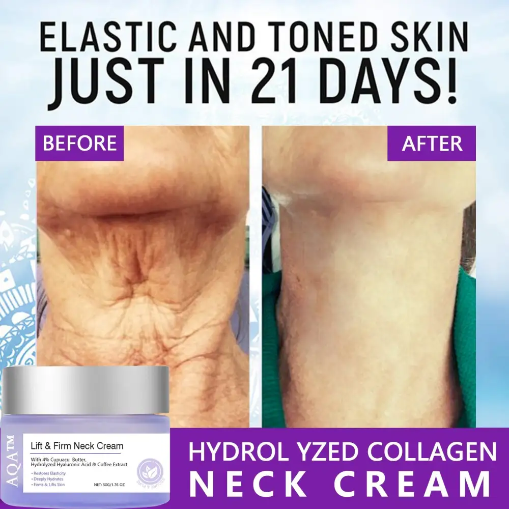 ✨Last Day Discount: 70% OFF🌸Neck Cream