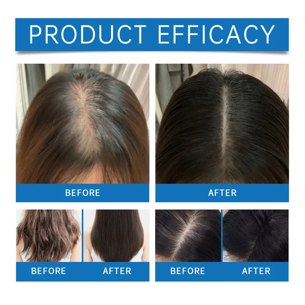 Rosemary Hair Care Roll-on Essence