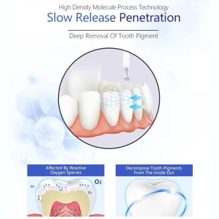 NEW Reactive Oxygen Species Teeth Whitening Pen