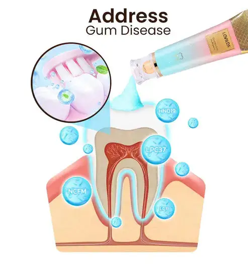 💥HUGE DISCOUNT - 50% OFF! LIMITED TIME! Niacinamide Whitening Toothpaste for a Bright Smile.💪 GRAB IT NOW!