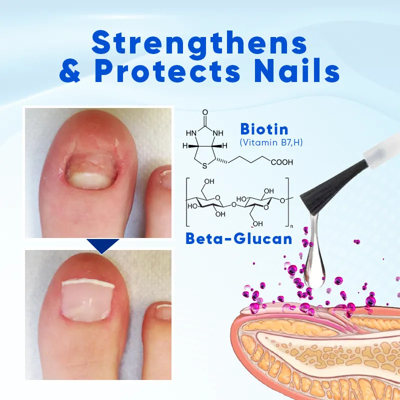 🚨FLASH SALE - 50% OFF!🔥URGENT! LIMITED TIME! OnyxoGuard Nail Growth and Repair Serum for Beautiful Nails.🛒ORDER NOW!