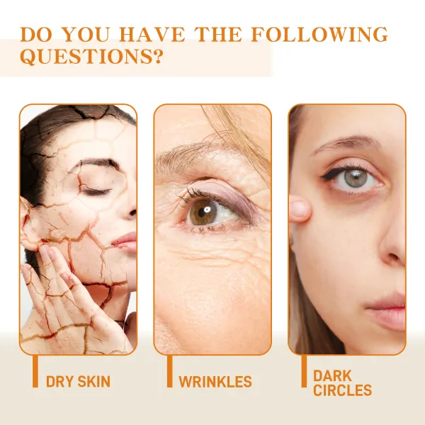 Brightening Essence, Fading Spots and Fine Lines, Anti-Wrinkle, Whitening Skin, Hydrating and Moisturizing Facial Essence-$SY