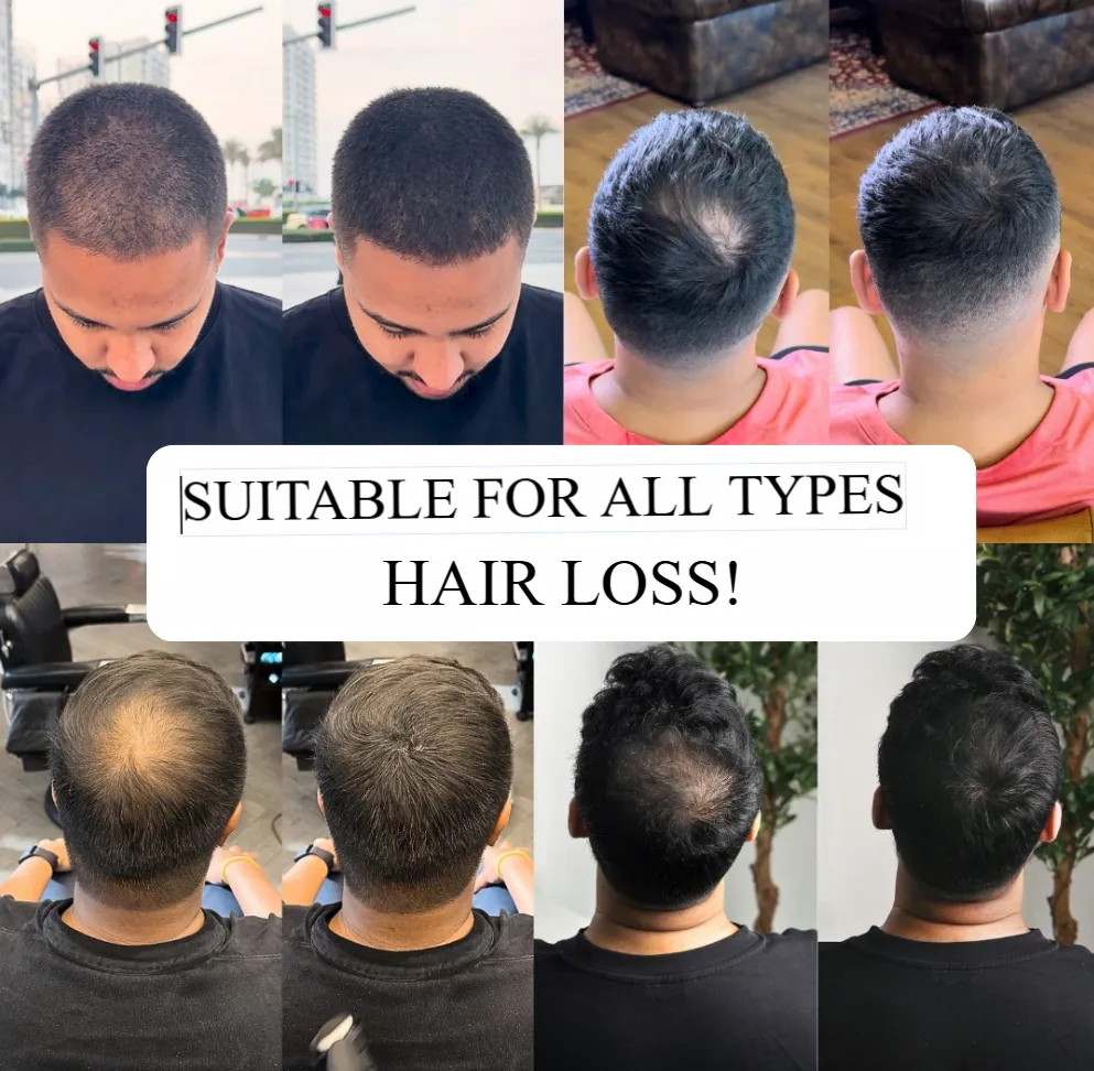 Say Goodbye to Receding Hairlines! Hairline Shadow Powder, Redefine Your Perfect Hairline