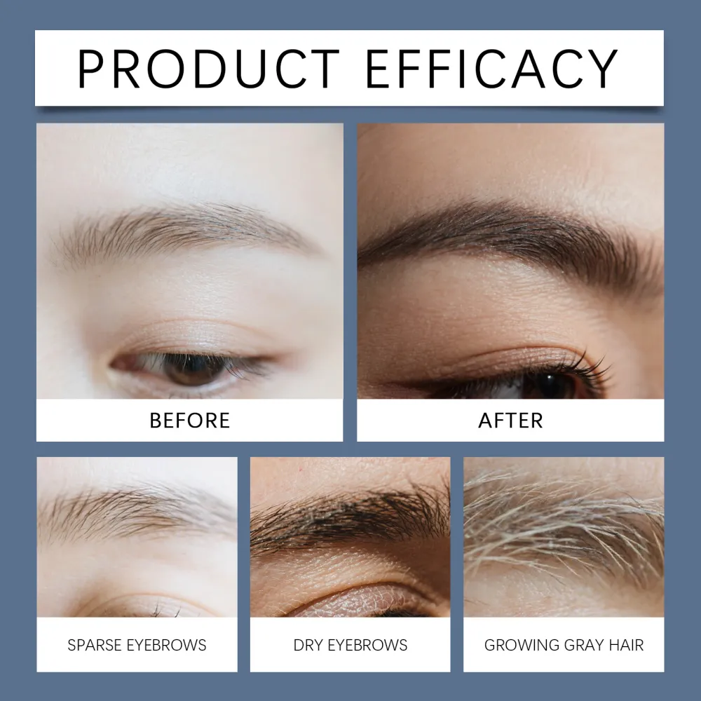 Viareline Eyebrow Care Essence - Gentle Nourishing, Natural, Beautiful, Long and Moisturizing Eyebrow Care Solution-$HT