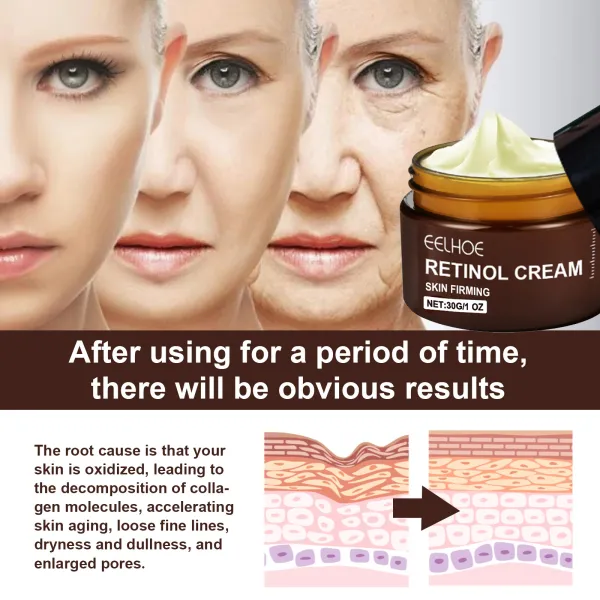 EELHOE Retinol Cream - Anti-aging, Firming, Brightening, Moisturizing Facial Skincare Cream-WH