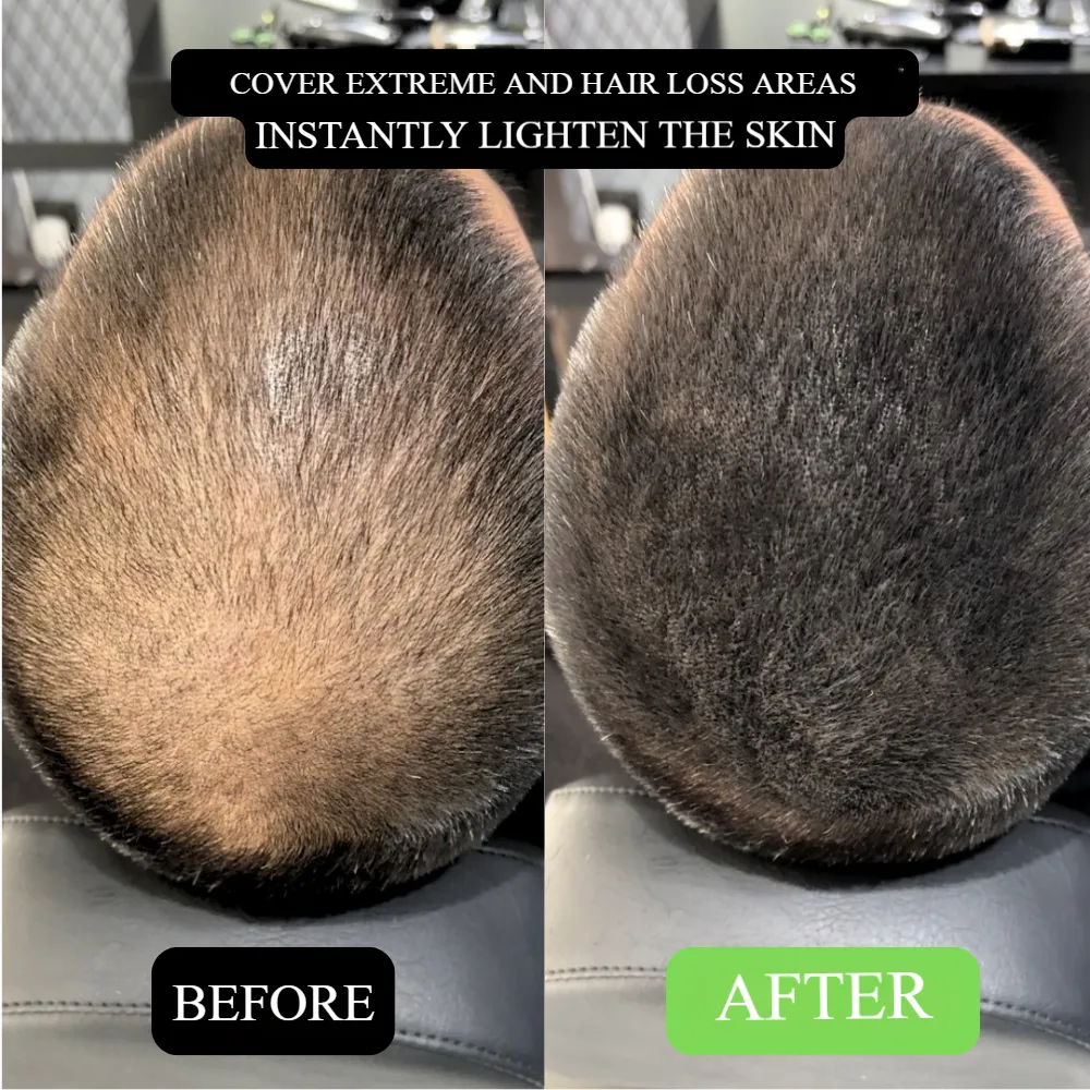 Say Goodbye to Receding Hairlines! Hairline Shadow Powder, Redefine Your Perfect Hairline