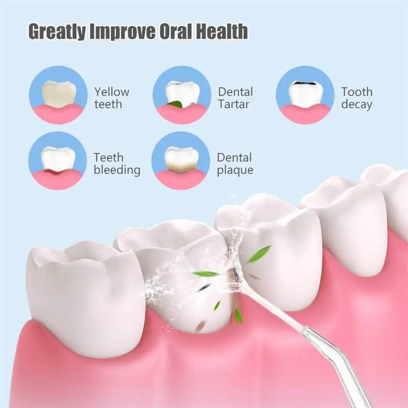 Electrically powered dental irrigator for thorough cleaning