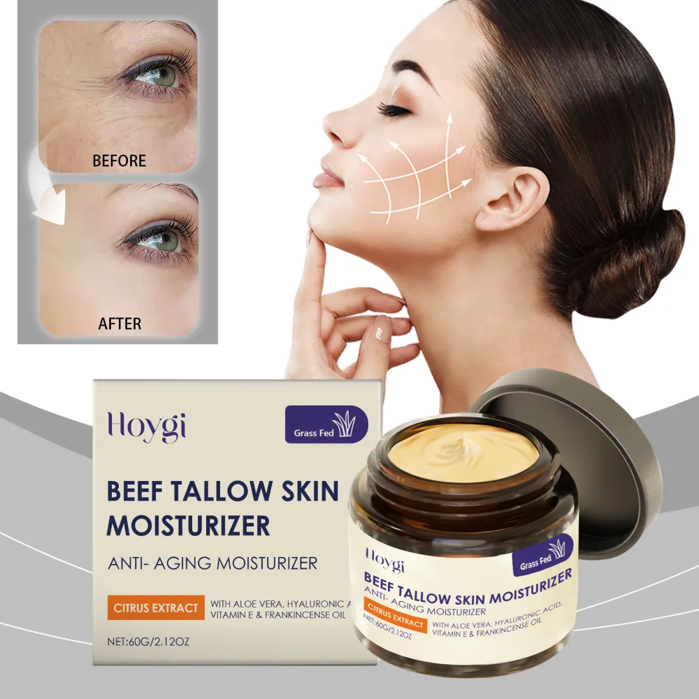 Hoygi Beef tallow moisturizing cream
