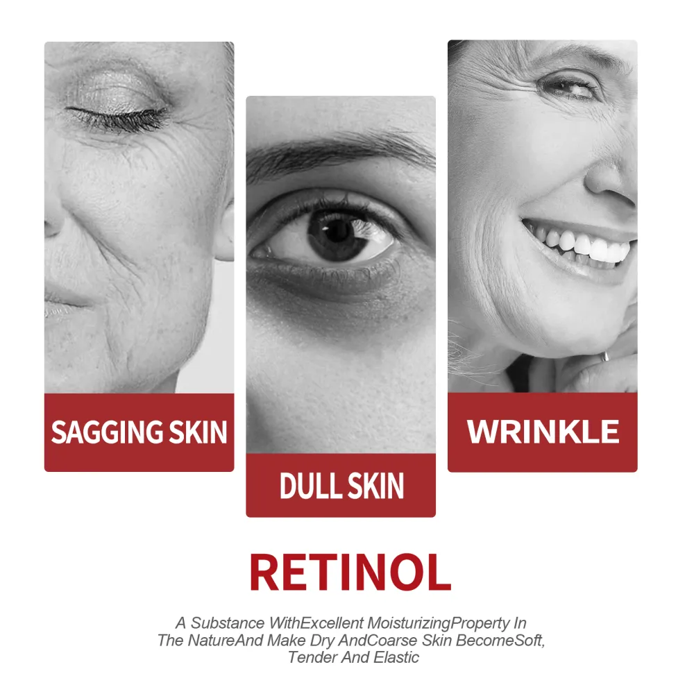 Retinol Moisturizing Cream Lightens fine lines, dark circles, moisturizes and tightens pores, anti-aging cream-$AAA