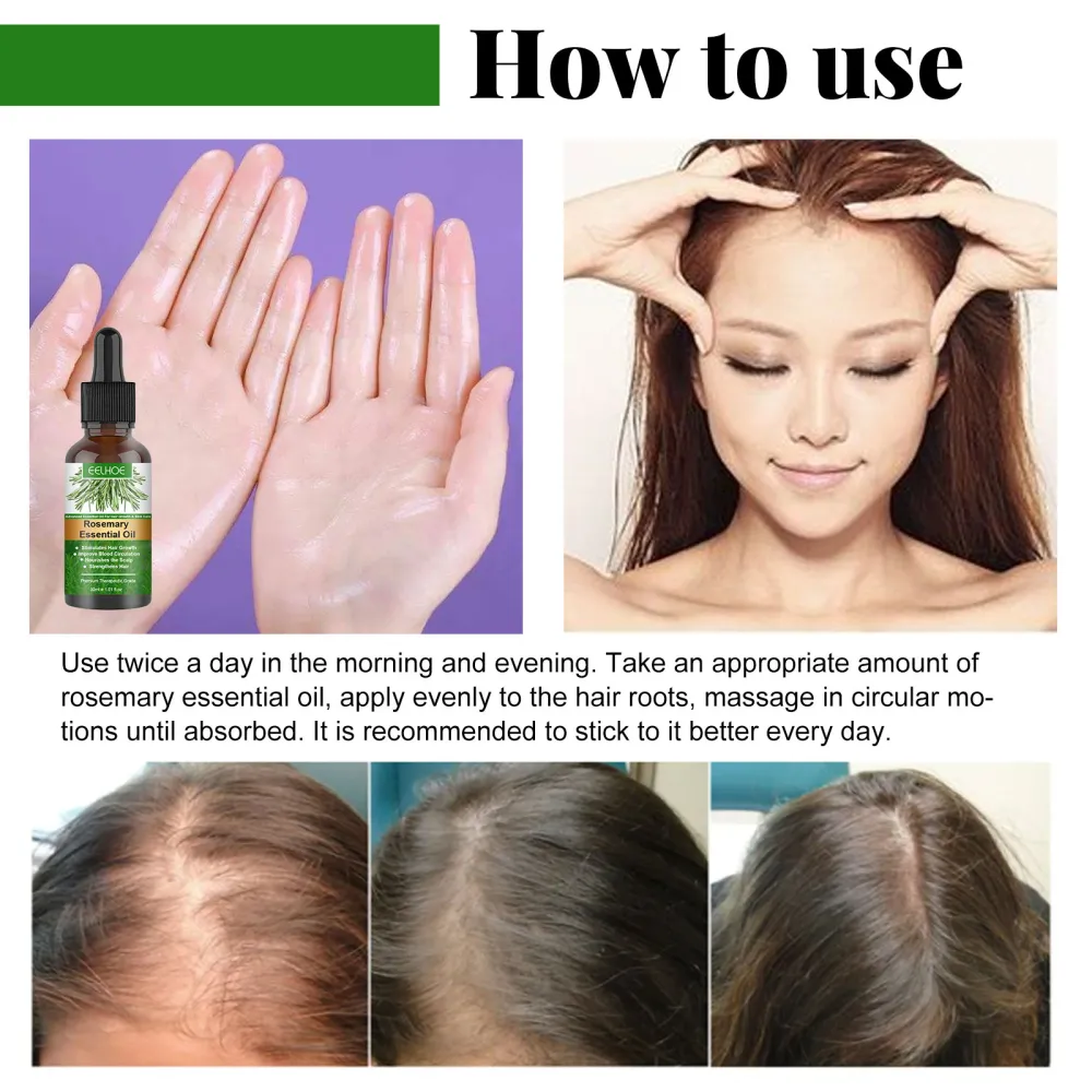 EELHOE  Natural plant extract rosemary hair care essential oil, gentle maintenance of scalp, soft and shiny hair, natural fluffy and healthier-$LA