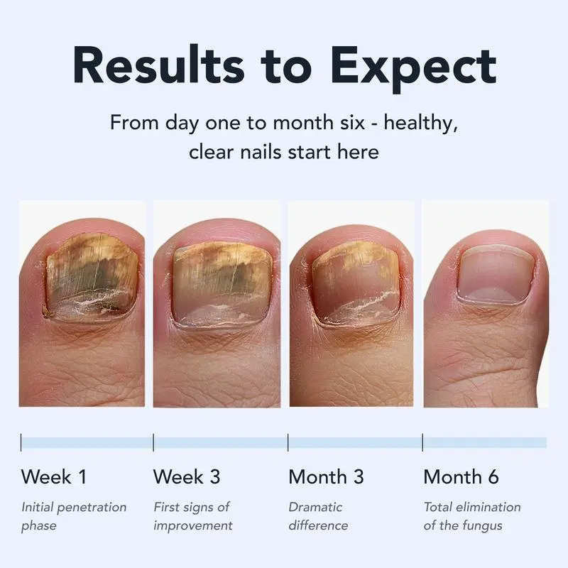 Daily Solution for Brittle & Thickened Nails