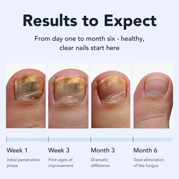 Daily Solution for Brittle & Thickened Nails