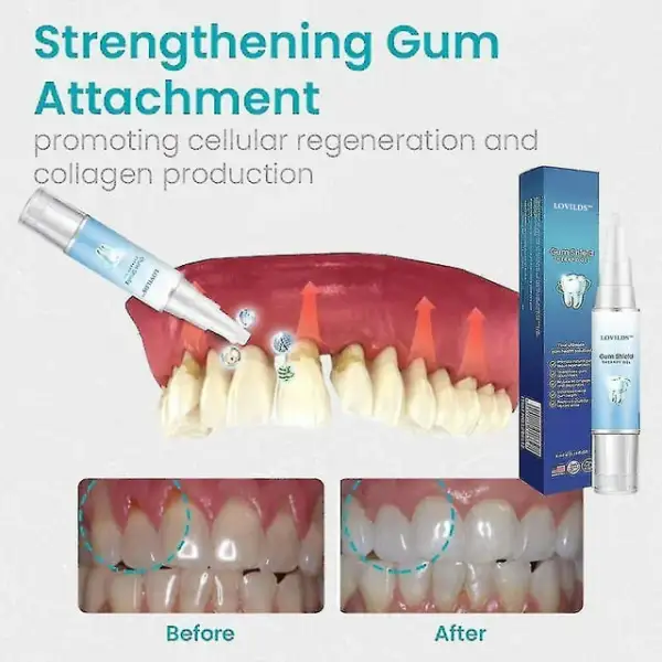 Tooth Repair Gel, Max 80% Off - Clean Deep, Firm Tartar, Soothe Gums!