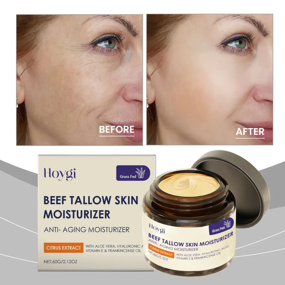 Hoygi Beef tallow moisturizing cream