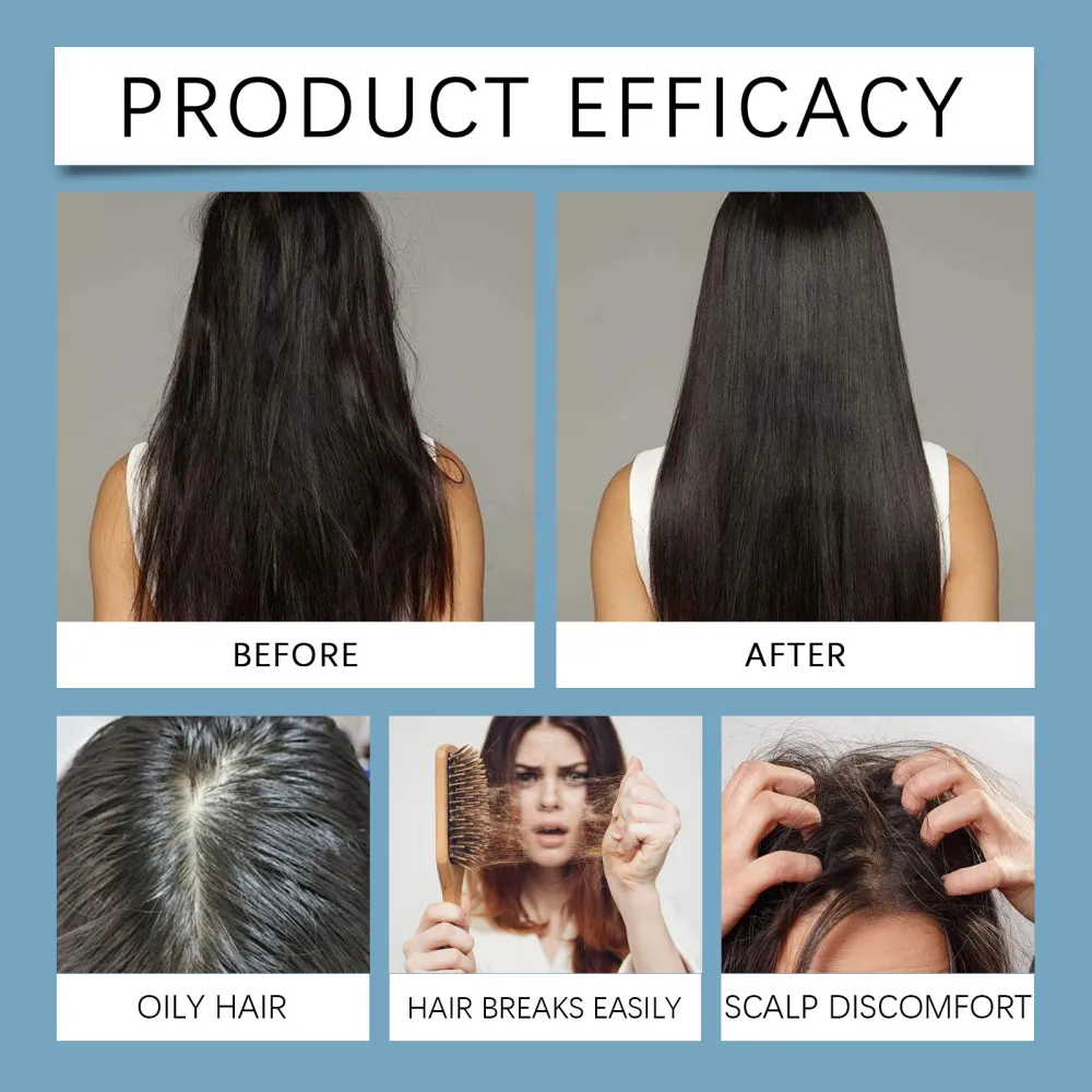 Hoegoa nourishing and moisturizing hair care essential oil, a gentle and refreshing hair care essence that nourishes and cares for hair roots and hair quality-$HT