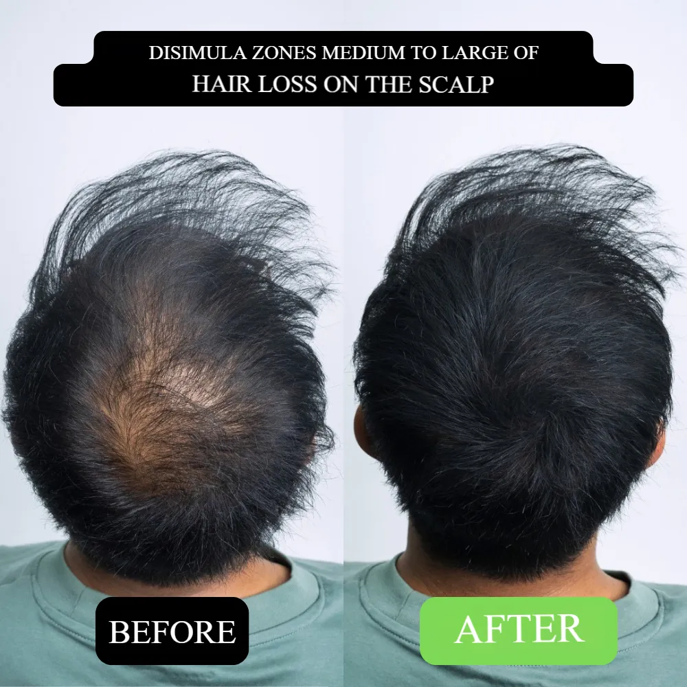 Say Goodbye to Receding Hairlines! Hairline Shadow Powder, Redefine Your Perfect Hairline