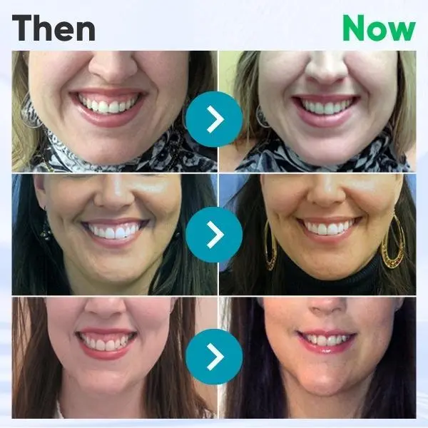 80% OFF! 🔥 LAST DAY!) Gum Therapy Gel