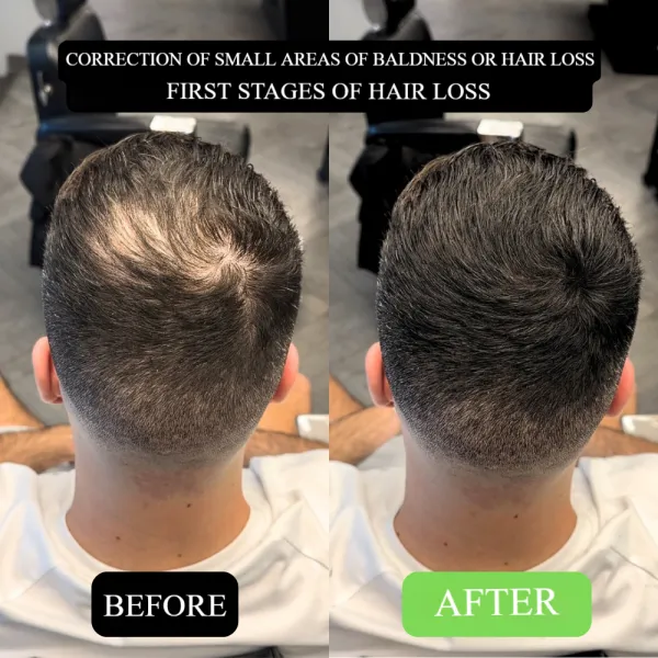 Say Goodbye to Receding Hairlines! Hairline Shadow Powder, Redefine Your Perfect Hairline