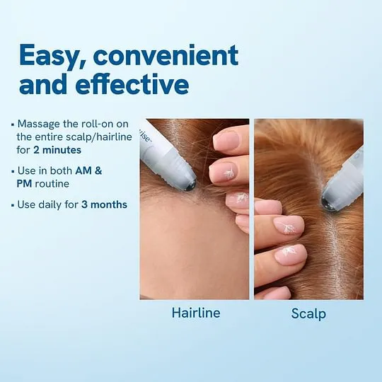 Be Bodywise Advanced Hair Growth Roll-On Serum | 3% Rosemary | 2% Aminexil | 3% Redensy l 2% Anagain | Precision Scalp Applicator | Paraben & Sulphate Free | Non oily and mess free