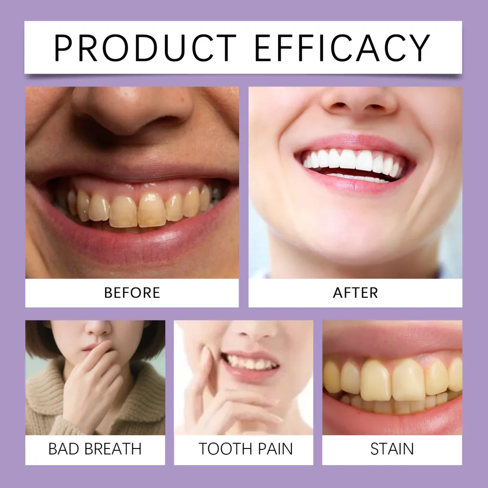 Oralhoe Purple Tooth Powder, Whitening and Gum Care, Cleanses Teeth, Freshens Breath, Cleanses Mouth, Freshens Care-$HT